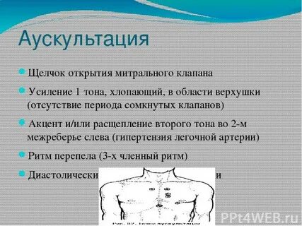 Тон открытия митрального клапана