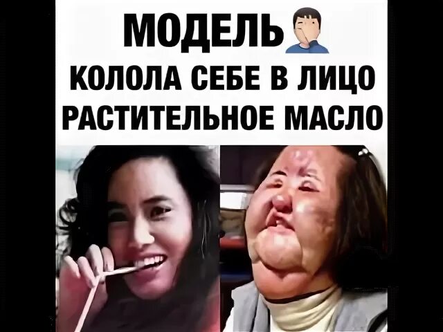 Ввела под кожу