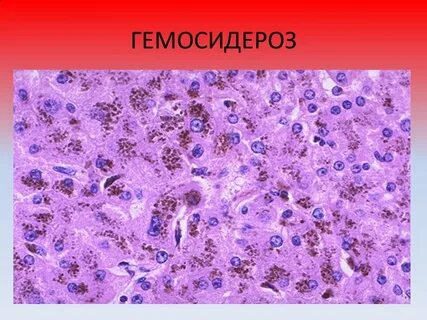 Макрофаги селезенки