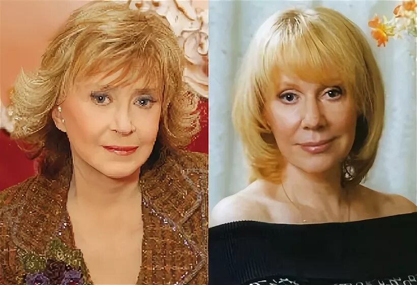 Хирург развел на доверие. Звездные красавицы, пожалевшие о пластике