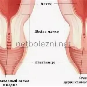 Цервикальный канал матки. Шейка цервикальный канал. Расширение цервикального канала матки. Цервикальный канал женских органов. Цервикальный канал размеры