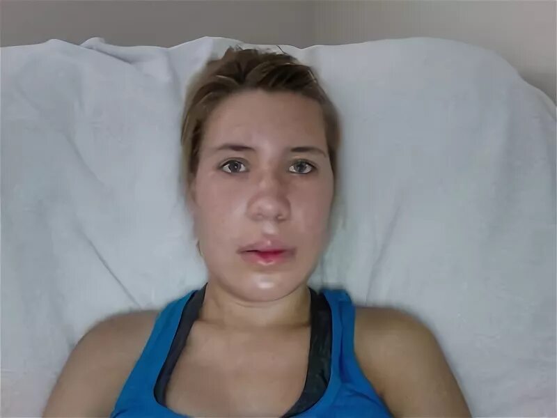 Отекшее лицо по утрам у женщин