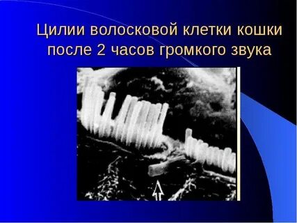 Колебания волосковых клеток