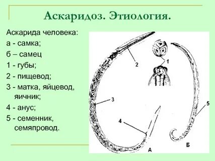 Аскаридоз этиология