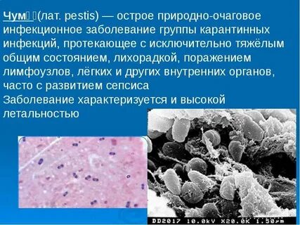 Чума группа инфекций