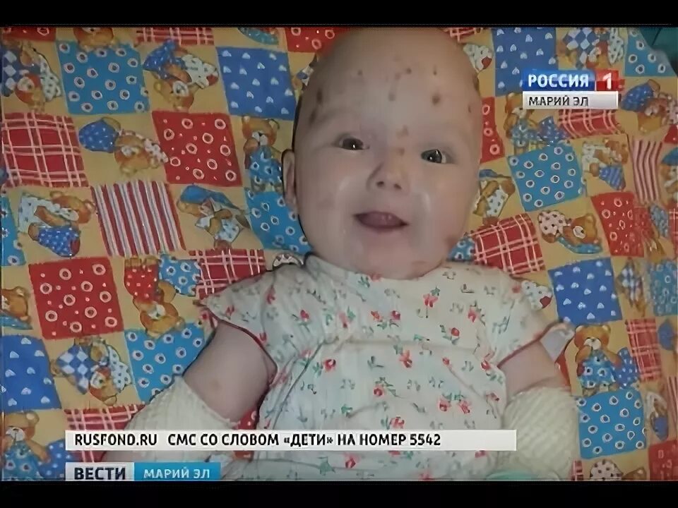 ЭТА ПОМОЩЬ ЖИЗНЕННО НЕОБХОДИМА!