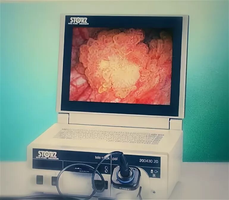 Где делают цистоскопию. Где делают цистоскопию