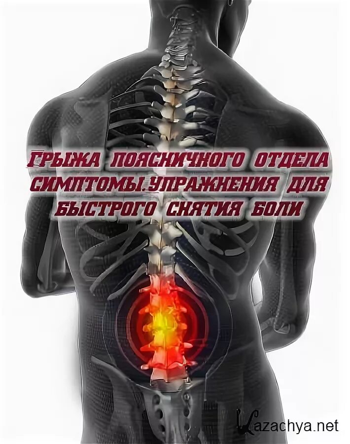 Боль при грыже поясничного отдела позвоночника. Грыжа поясничного отдела. Грыжа поясничного отдела симптомы. Поясничная грыжа симптомы.