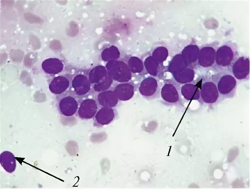 Цитологическое исследование пунктата