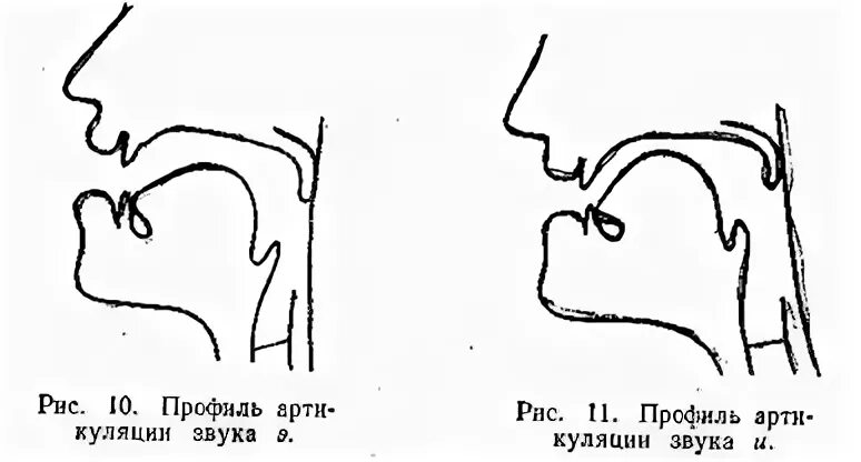 Произношение звука э. Артикуляционный профиль звуков при ринолалии.