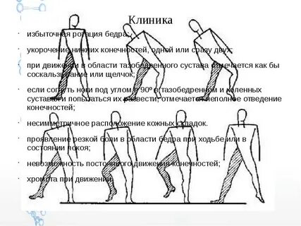 Ротация сустава