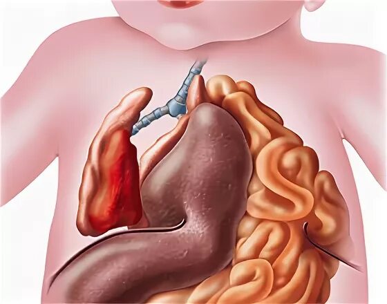 Увеличенная печень у ребенка. Селезенка у новорожденных. Печень увеличилась у детей.
