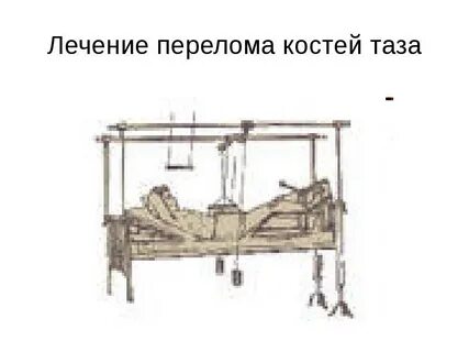 Таза лечение