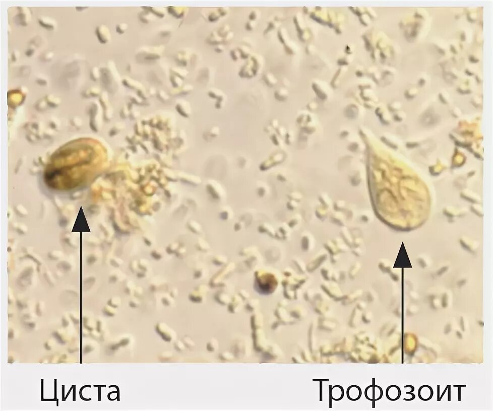 Цисты лямблии микроскопия. Цисты лямблий микроскопия. Лямблии микроскопия кала. Цисты лямблий микроскопия кала.