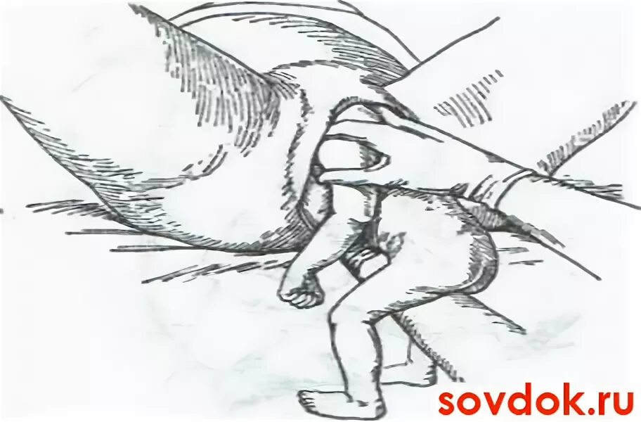Пособие по цовьянову. Цовьянов ягодичное предлежание. ручного акушерского пособия по цовьянову. пособие в родах по цовьянову. пособия по цовьянову 2 при тазовых предлежаниях.