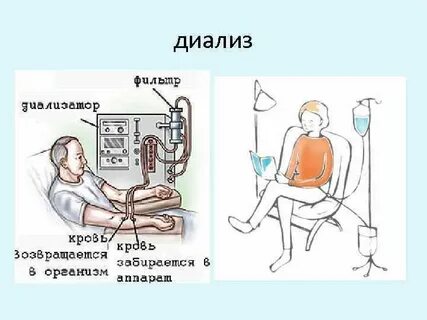 Диализ инвалиду