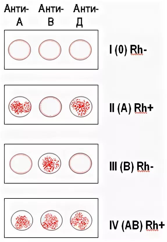 Резус фактор крови цоликлонами. Цоликлоны группа крови схема. Определение группы крови и резус фактора цоликлонами таблица. Группа крови Цоликлоны резус. Определение группы крови и резус фактора цоликлонами.