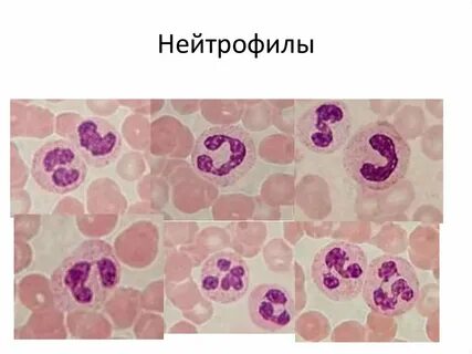 Сегментоядерные лейкоциты
