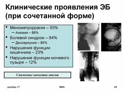 Сочетанная форма