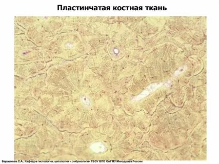 Мягкая костная ткань