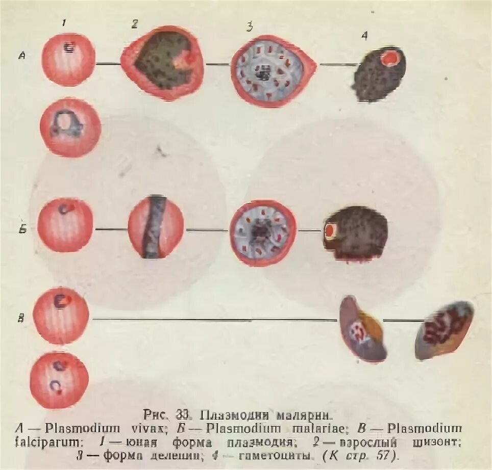 Микрогаметоцит это. Трофозоит малярийного плазмодия. Кольцевидный трофозоит малярийного плазмодия. Шизонт малярийного плазмодия строение. Стадии развития малярийного плазмодия в эритроцитах.