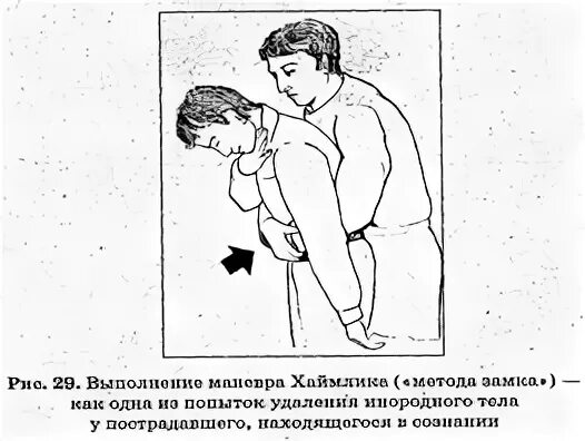 Последовательности этапы устранения непроходимости дыхательных путей. Последовательности этапы устранения непроходимости дыхательных путей