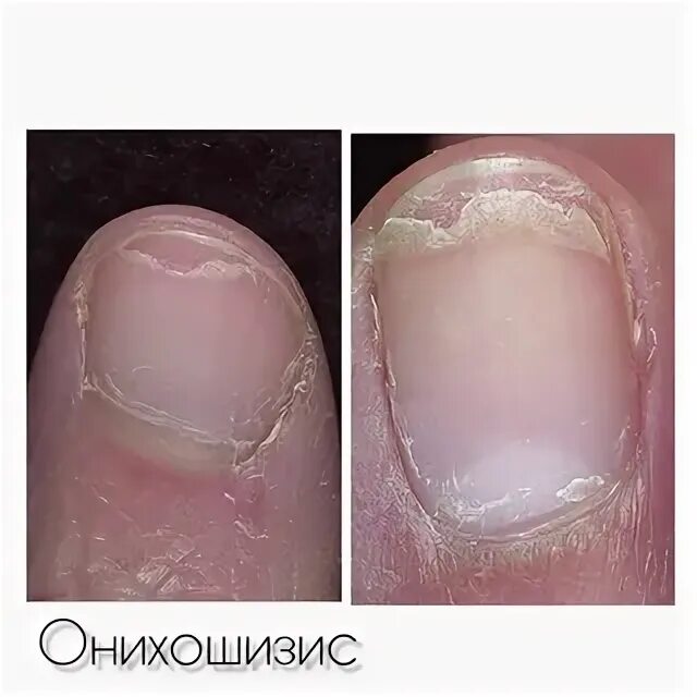 Ногтевые слои. Форма ногтей овал вид сбоку. Ногтевые слои. Строение ногтевой пластины схема. Последовательность наращивания ногтей.