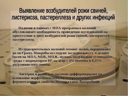 Возбудитель рожи