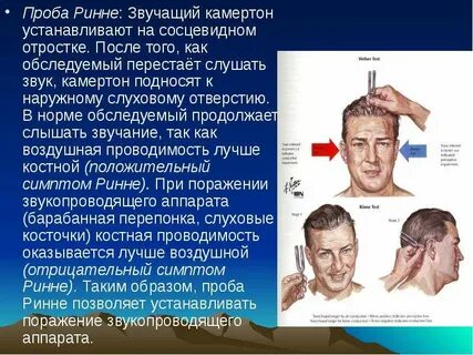 Ринне вебера