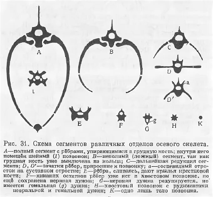 Кости при остеосаркоме. Дистальный диафиз большеберцовой кости. Костные сегменты. Полный костный сегмент. Костные сегменты.