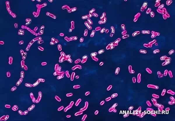 Bordetella pertussis iga