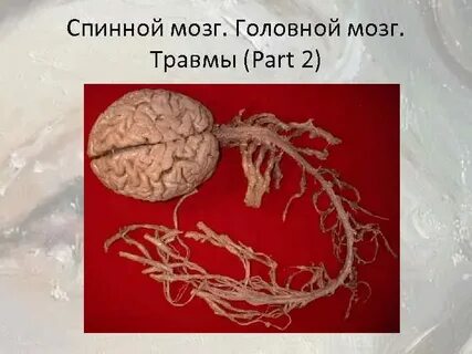 Заболевания нервной системы спинного и головного мозга