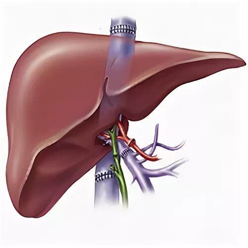 Трансплантология печени. Трансплантология печени. Печень после трансплантации. Ортотопическую трансплантацию. Печень после трансплантации.