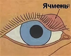 Ячмень в уголке