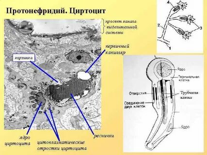 Полость протонефридия
