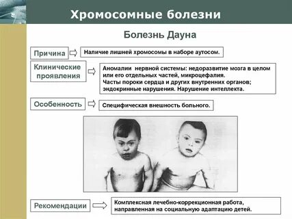 Болезни с хромосомами