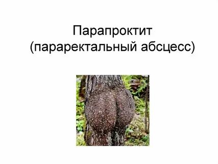 Парапроктит что это