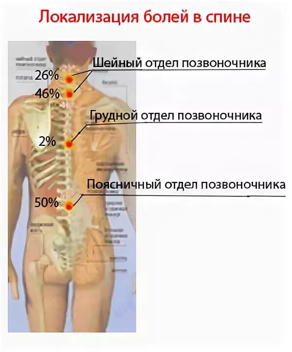 Болит справа от позвоночника. Локализация боли в спине на картинках. Болит спина. Локализация боли в позвоночнике. Болит середина спины.