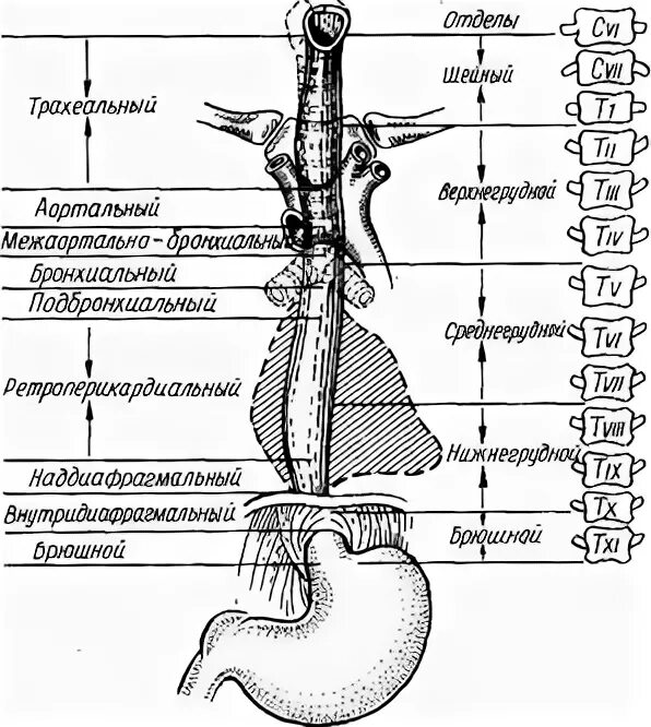 Синтопия пищевода