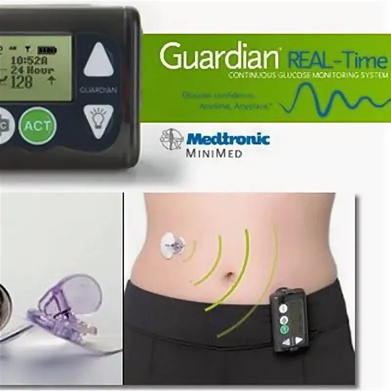 Real time monitoring system. Guardian real-time (medtronic, сша). медтроник мониторинг глюкозы гардиан. система гардиан медтроник. медтроник система мониторинга.