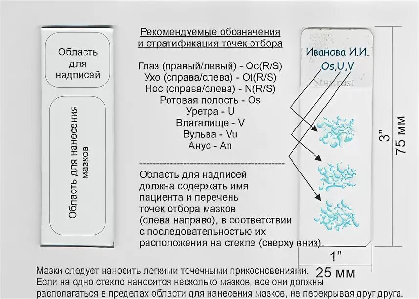 Мазок на гонорею алгоритм. Нанесение мазка гинекологического на предметное стекло. обозначение на гинекологических мазках. маркировка предметных стекол. мазок на предметном стекле гинекологический.