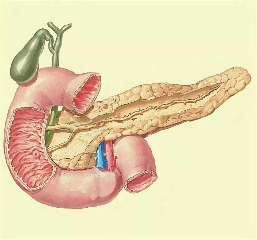 Санториниев проток поджелудочной железы. Вирсунгов проток поджелудочной железы. Вирсунгов проток анатомия. Вирсунгова протока поджелудочной железы. Поджелудочная железа камни операция
