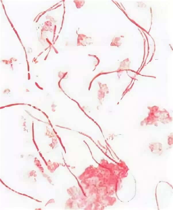 Fusobacterium spp