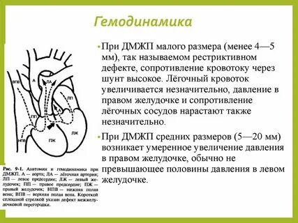 Между желудочками