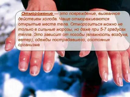 Отморожению чаще всего подвергаются