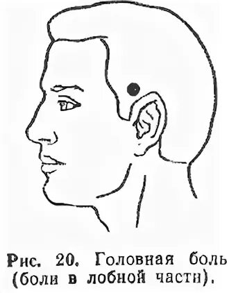 Давление болит лобная часть головы. Головная боль в лобной. Если голова болит в лобной части. Боль во лбу. Напряжение в лобной части головы.