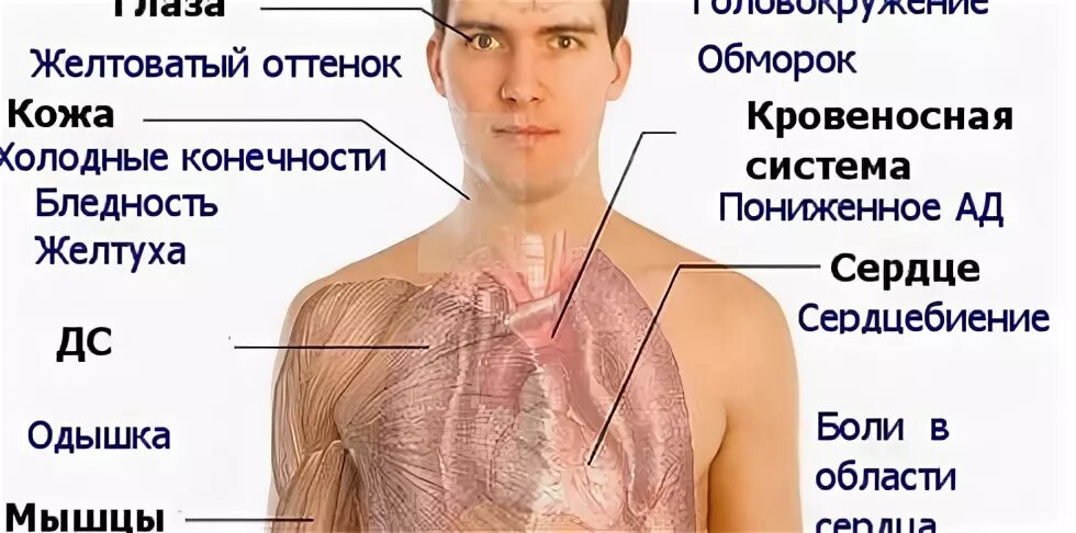 Головокружение при анемии. Боли в сердце при анемии.