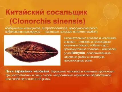 Китайский сосальщик