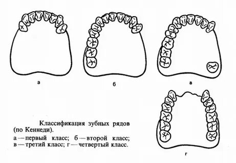 Классификация зубных рядов