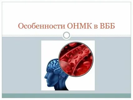 Вертебро базилярный инсульт